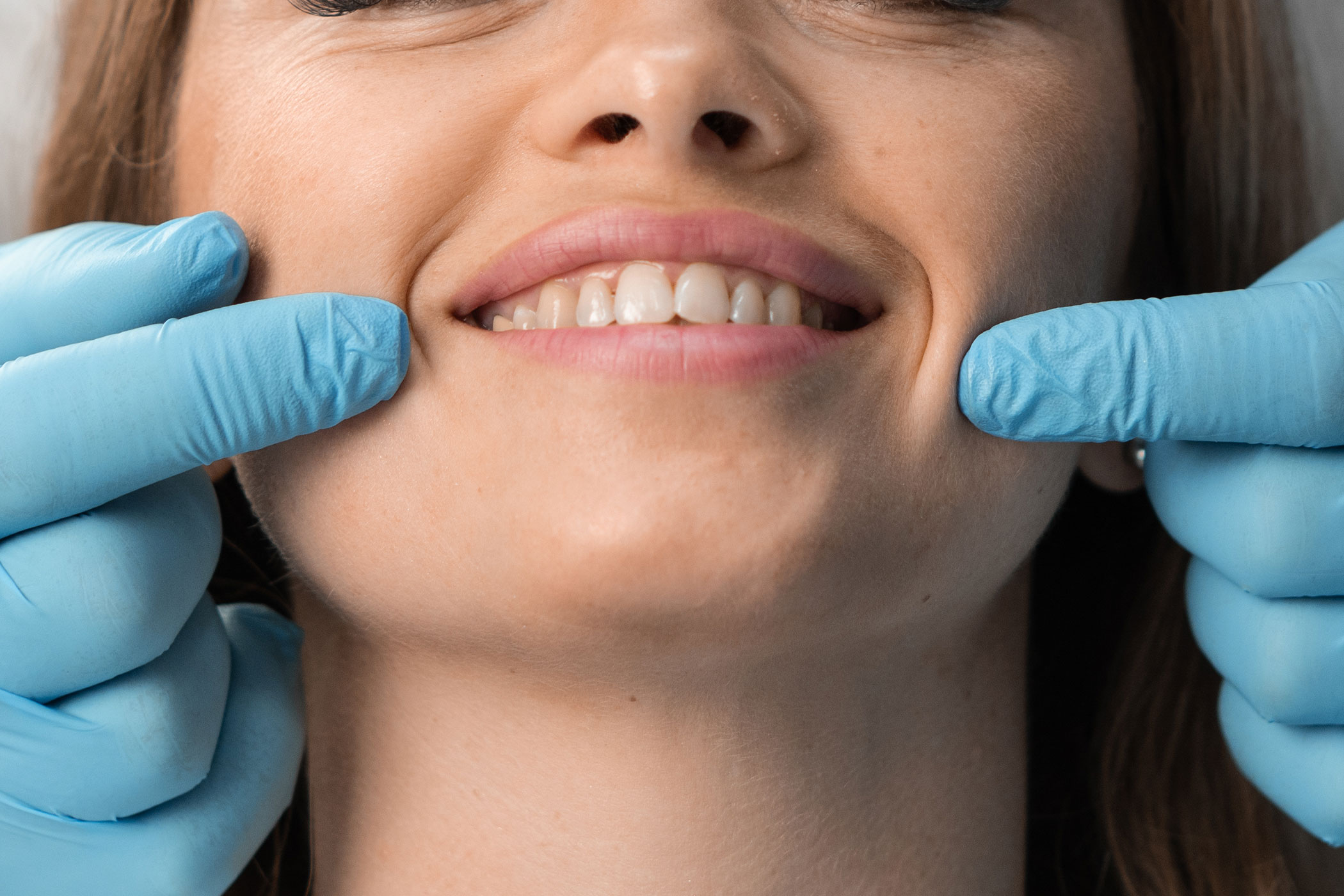 Dentista a Milano Odontoiatria Mininvasiva