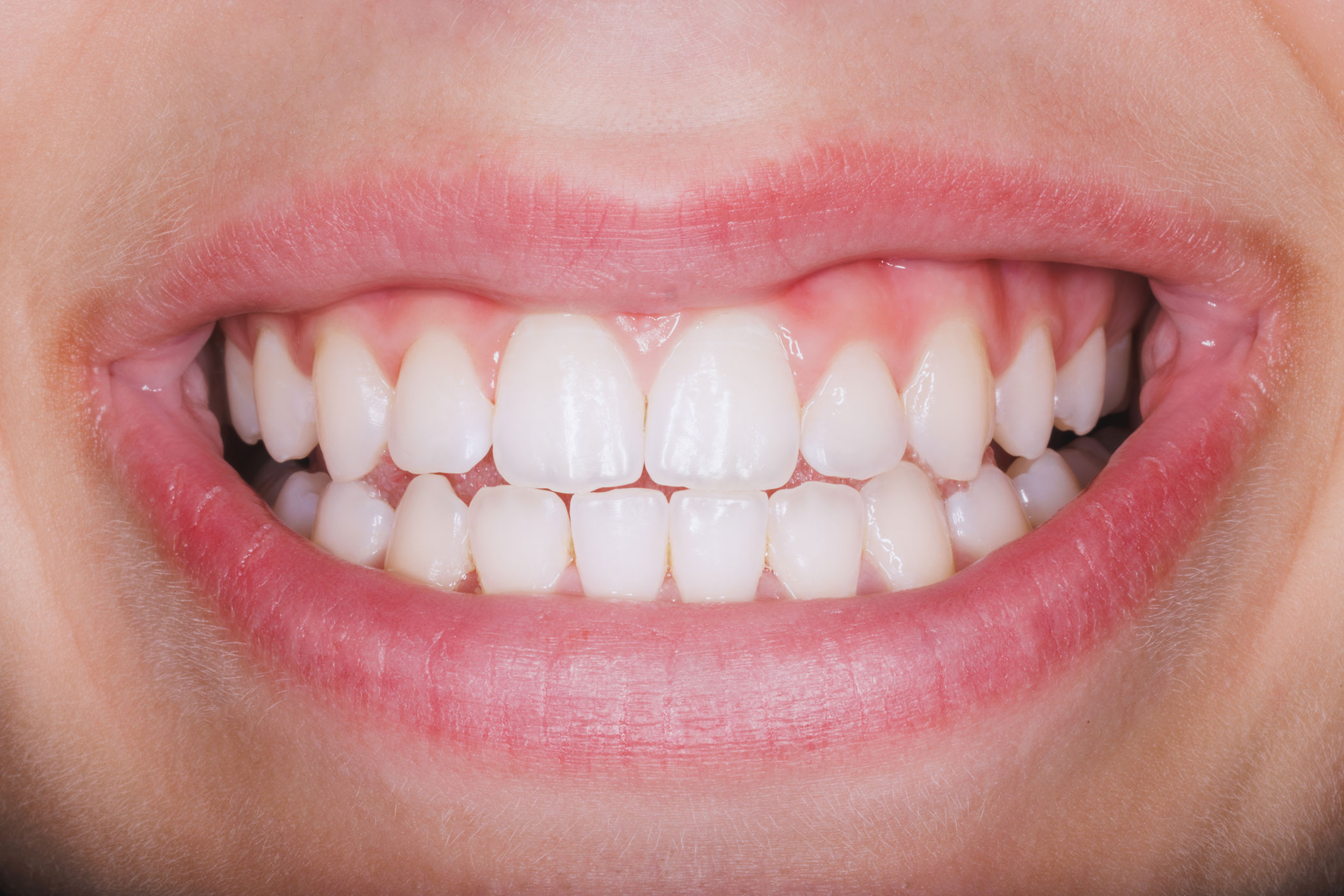 Dentista a Milano Parodontologia