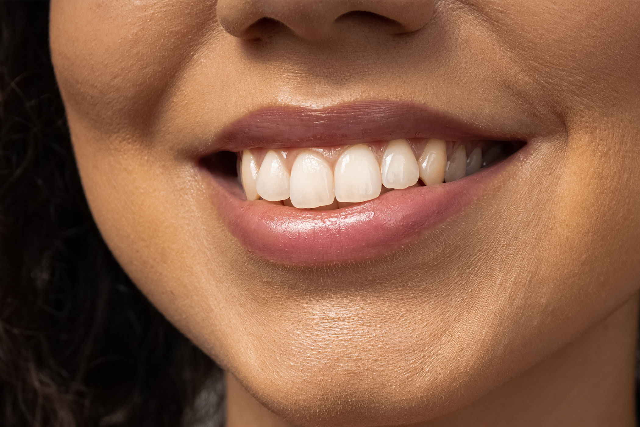 Dentista a Milano Sbiancamento Dentale