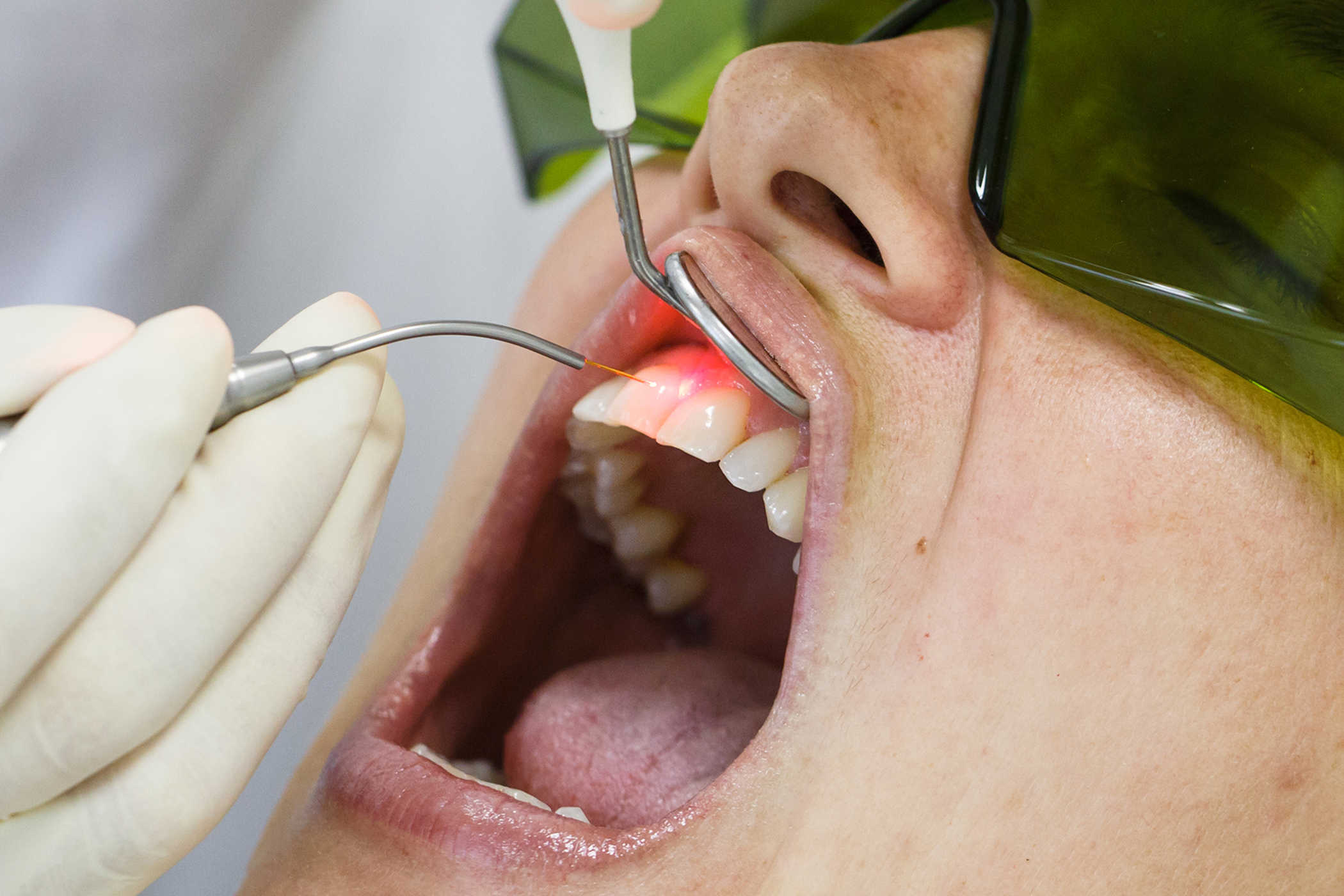 Dentista a Milano Laserterapia