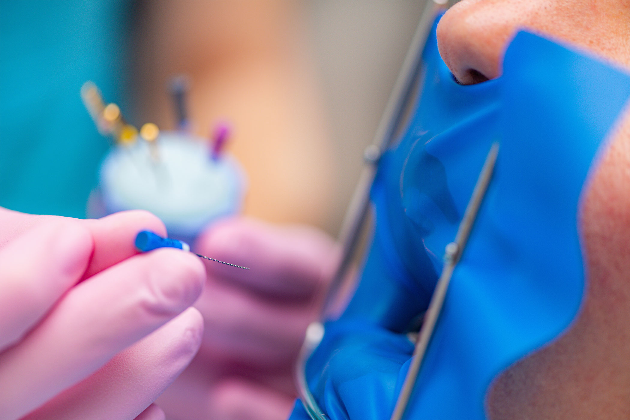 Dentista a Milano Endodonzia