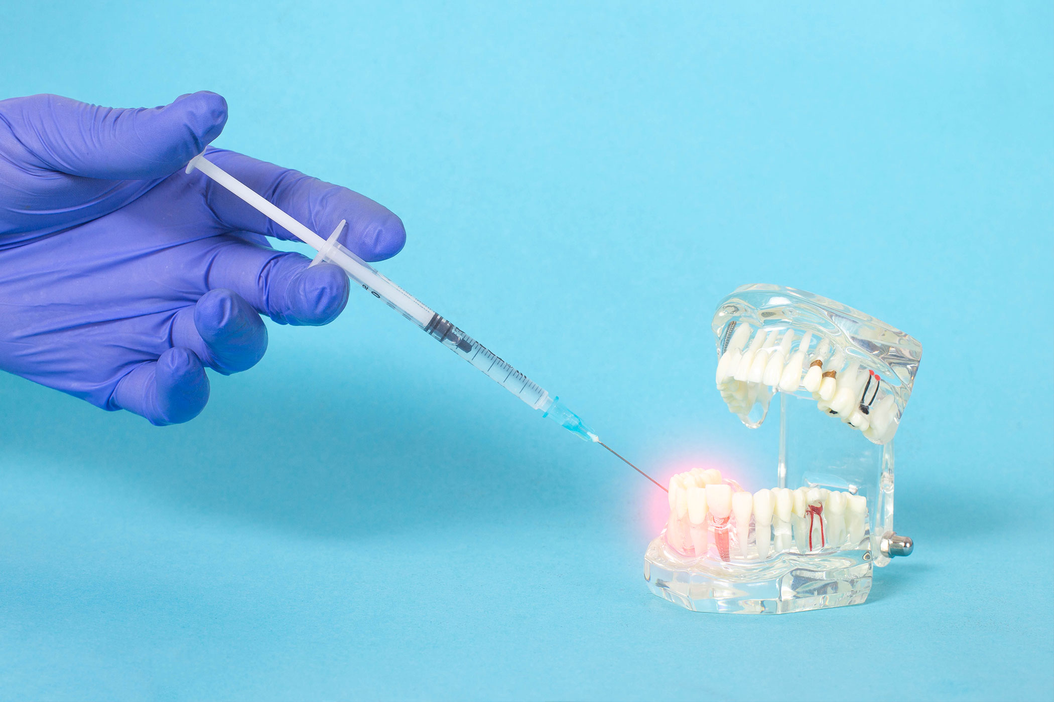 Dentista a Milano Ozonoterapia